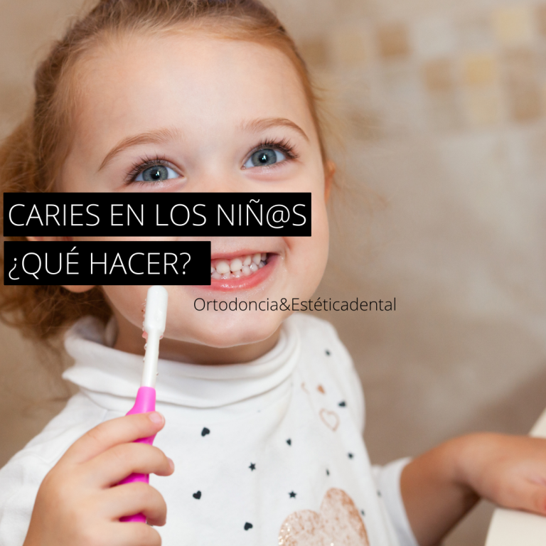 CARIES EN LOS NIÑOS, ¿QUÉ HACER?