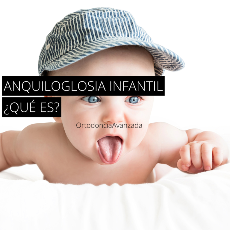 ANQUILOGLOSIA INFANTIL ¿QUÉ ES?