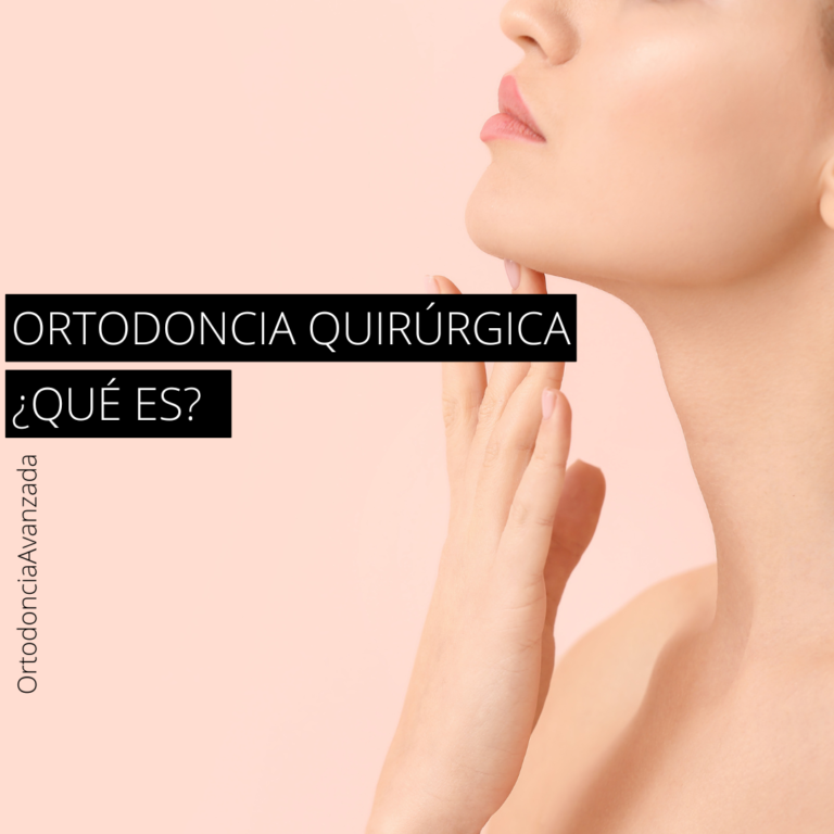 ORTODONCIA QUIRÚRGICA, ¿QUÉ ES?